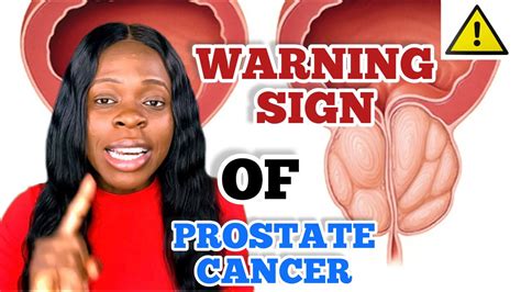 5 Warning Signs Of Prostate Cancer Prostate Cancer How Do I Know I Am