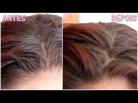 Como Disfarçar Cabelo Oleoso DIY de 1 ingrediente YouTube