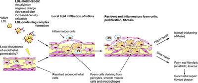 Frontiers Cellular Mechanisms Of Human Atherogenesis Focus On