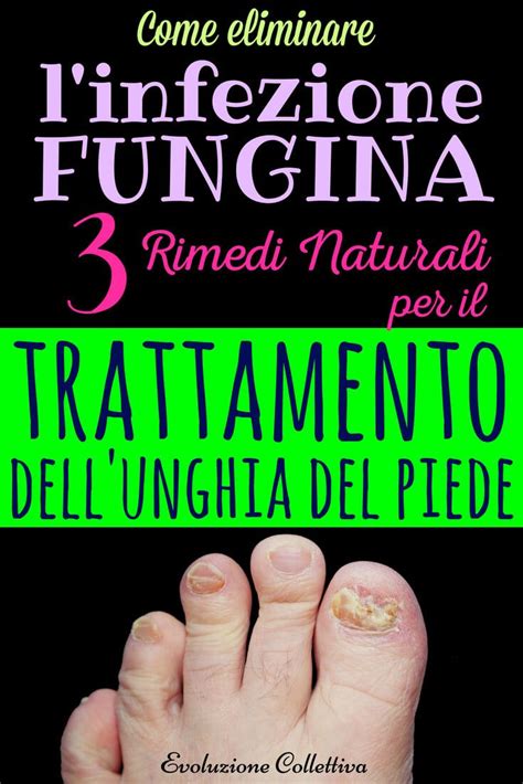 Rimedi Della Nonna Per Funghi Ai Piedi