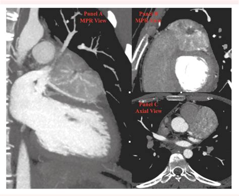 Figure From Role Of Integrated Imaging In The Diagnosis Of An