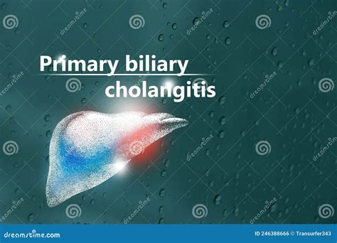 Medical Banner Primary Biliary Cholangitis On Blue Background With