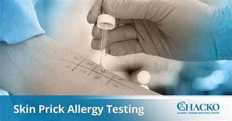 Skin Prick Allergy Testing in Atlanta – Chacko Allergy