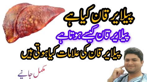 Hepatitis B Hepatitis B Kya Hota Hai Hepatitis B Symptoms Causes Of