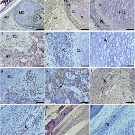 Expression Of Sox 5 Protein A L A General TMJ Image With Mandibular