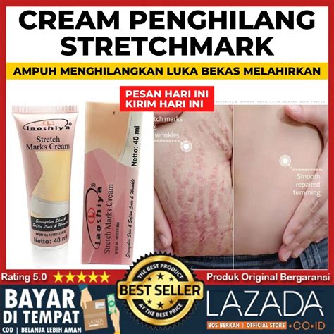 PENGHILANG BEKAS TANDA MELAHIRKAN STRETCH MARK CREAM LAOSHIYA