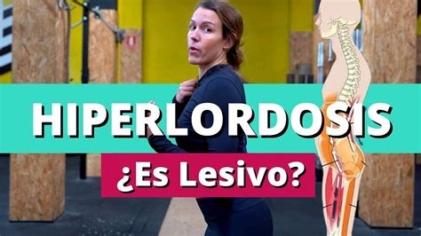 Hiperlordosis Qu Es Y Qu Debes Tener En Cuenta Para Entrenar