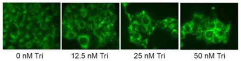 Triptolide Induces Protective Autophagy And Apoptosis In Human Cervical