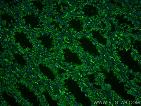 XIAP Antibody CL488 66800 Proteintech