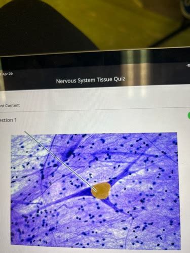 Nervous System Tissue Flashcards Quizlet