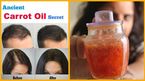 How To Regrow Hair Best Hair Oil To Stop Hair Loss A Magical Remedy