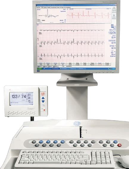 Ge Case Stress Test System Diagnostic Ultrasound Sales And Service