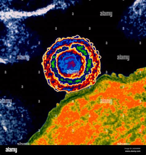 El virus del herpes simple Transmisión Color micrografía de electrones