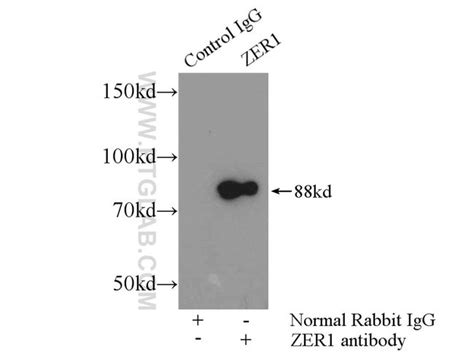 Zer Rabbit Anti Human Mouse Rat Polyclonal Proteintech L