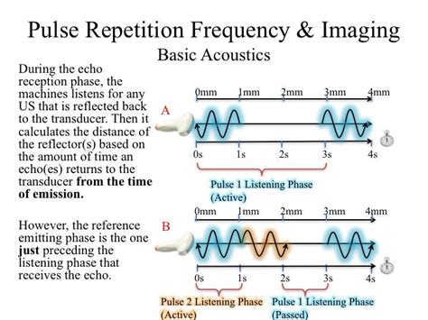 Internal Medicine Point Of Care Ultrasound IMPoCUS