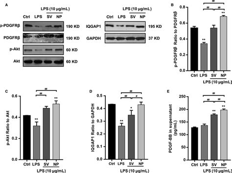 The effects of SV preparations on PDGFRβ phosphorylation Akt