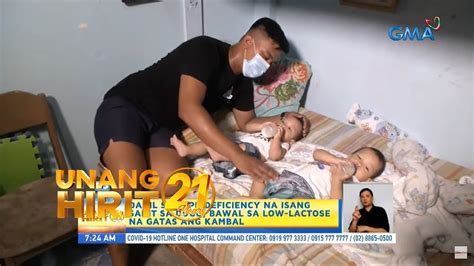 Unang Hirit Breastmilk Para Sa Kambal Na Sanggol Na May Sakit Sa Dugo