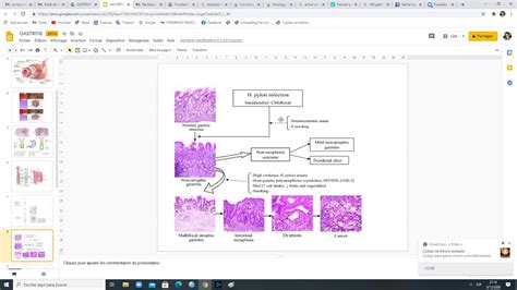 Biopsia G Strica Sistemas Sidney Y Olga Youtube