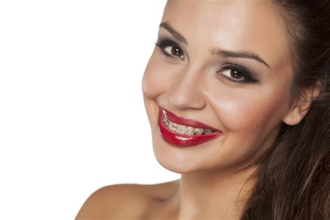 Alternatives For Braces What Are My Options This May Seem… Fresno