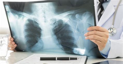 Chest Imaging What Your Chest Scan Can Reveal Touchstone Imaging