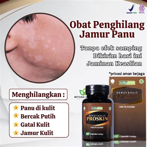 Jual Obat Panu Obat Penghilang Panu Obat Panu Cair Sabun Penghilang