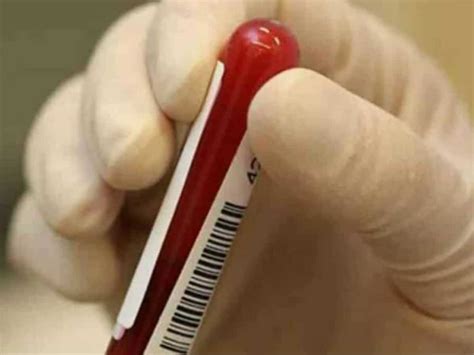 Beta Hcg Entenda Tudo Sobre O Teste De Gravidez De Sangue Explore O