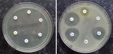 Olcreate Fleming Fund F Antimicrobial Susceptibility Testing Figure 5 The Disk Diffusion