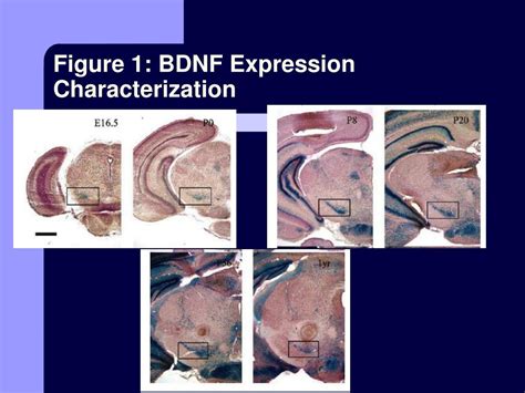 PPT BDNF And Parkinsons Disease PowerPoint Presentation Free