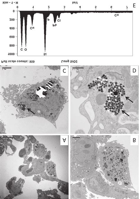 Transmission Electron Microscopy And EDX Microanalysis Of Murine Lung