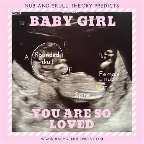 Nub And Skull Theory Was Right September 2019 Babies Forums What To