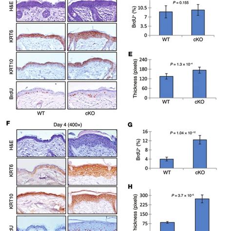 Loss Of Grhl3 Impairs Adult Mouse Epidermal Barrier Repair A Grhl3 Download Scientific