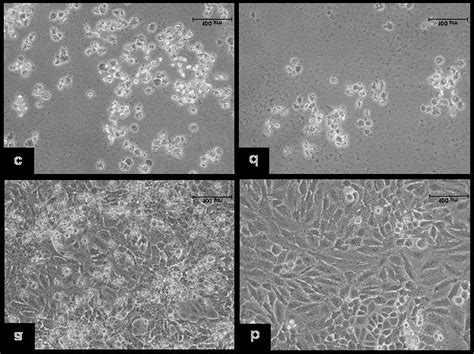 Morphological Changes Of HeLa Cells Treated With TQ For 72 Hours A