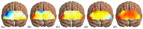 Comparison Of The Influence Of Dual Task Activities On Prefrontal