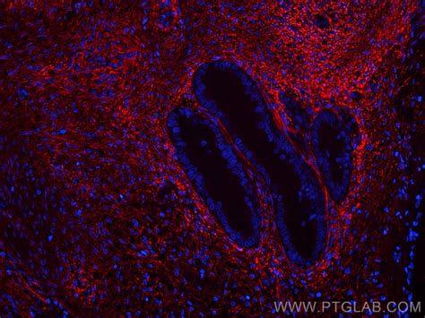 EMILIN1 Monoclonal Antibody 2A5C8 CoraLite594 Proteintech 100 μL