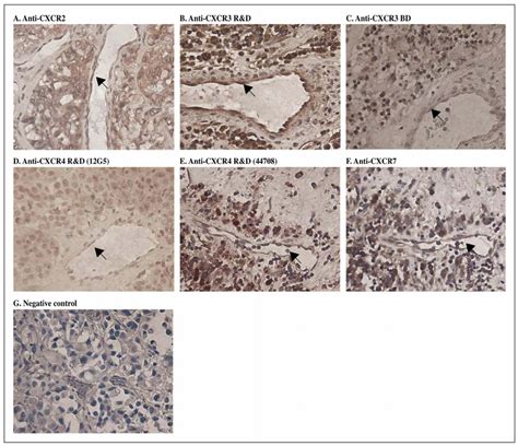 Expression Of CXCR2 CXCR3 CXCR4 And CXCR7 By Endothelial Cells And