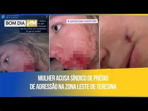 Mulher Acusa S Ndico De Pr Dio De Agress O Na Zona Leste De Teresina