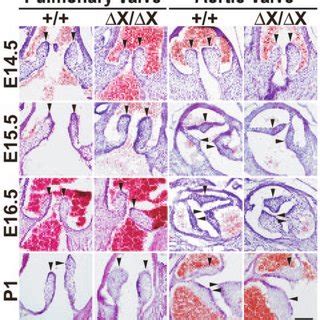 Semilunar Valve Defects In Plc X X Mice A The Aortic Valves