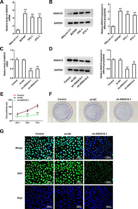 Expression Of ANXA10 In PTC Cell Lines And Effects Of ANXA10 Knockdown