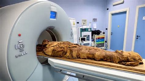 Hospital In Italy Uses CT Scan To Discover Secrets Of Egyptian Mummy