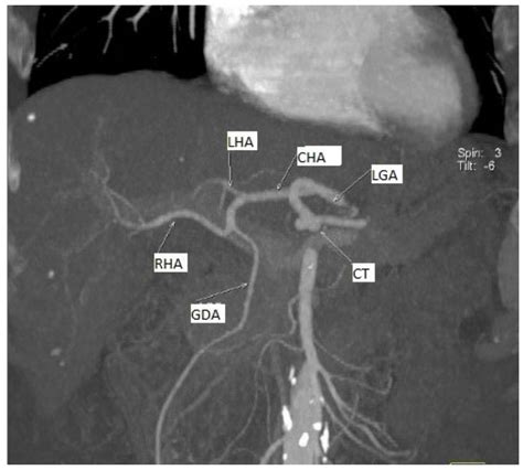 Diagnostics Free Full Text Clinical Consideration Of Anatomical