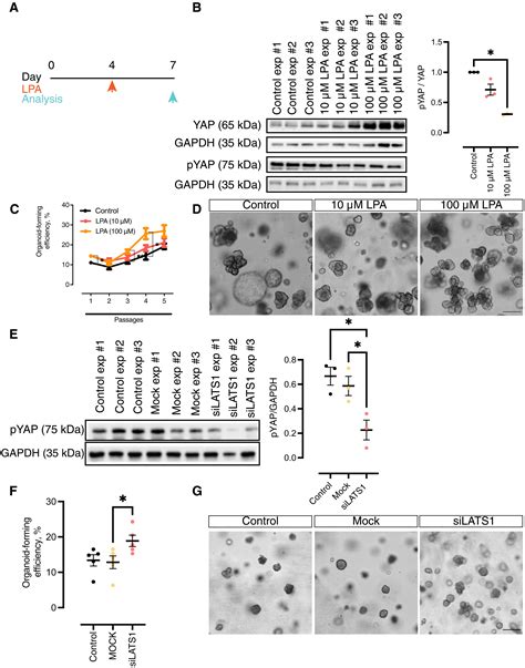 The Hippo Signaling Pathway Effector YAP Promotes Salivary Gland