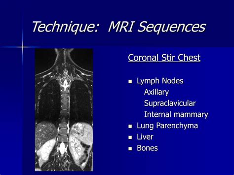 Ppt Breast Mri Powerpoint Presentation Free Download Id 1277218