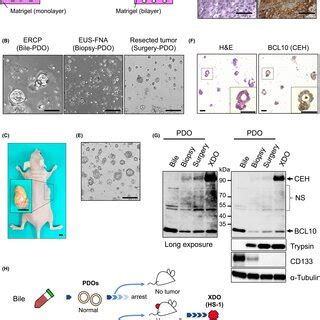 Propagation Of Patientderived Organoids Pdos And Development Of A