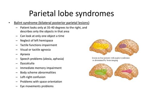 PPT Understanding Parietal And Temporal Lobe Syndromes PowerPoint