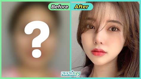 Sub Best 5 Plastic Surgery Transformation Korean Beauty