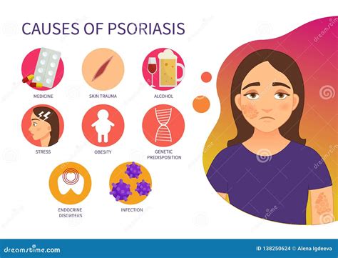 Causas Del Cartel Del Vector Del Psoriasis Ilustración del Vector