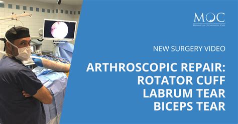 New video: Arthroscopic Rotator Cuff Repar | Manhattan Orthopedic Care