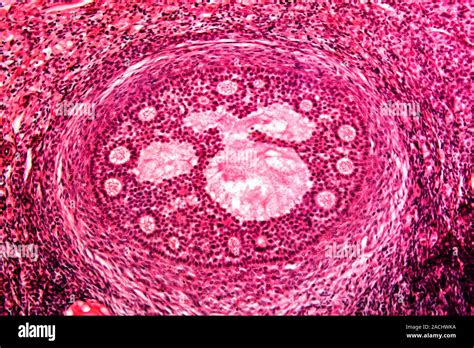 Ovarian Follicle Light Micrograph Of A Transverse Section Through A