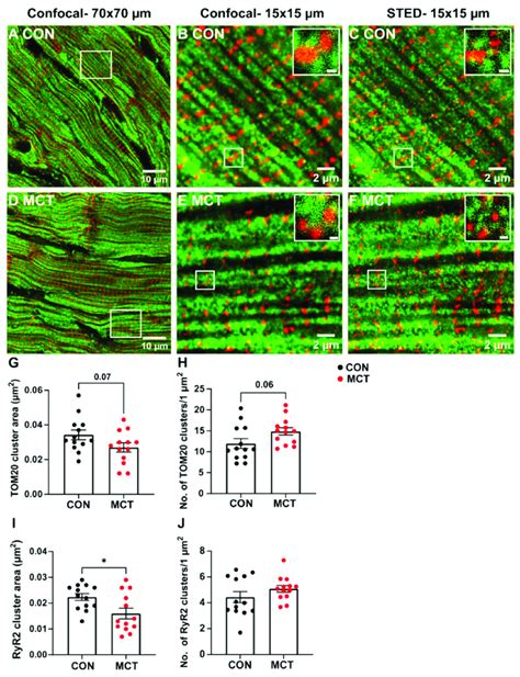 Confocal And Stimulated Emission Depletion STED Microscopy Of RyR2