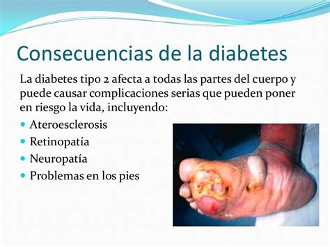 Diabetes Mellitus Tipo 2